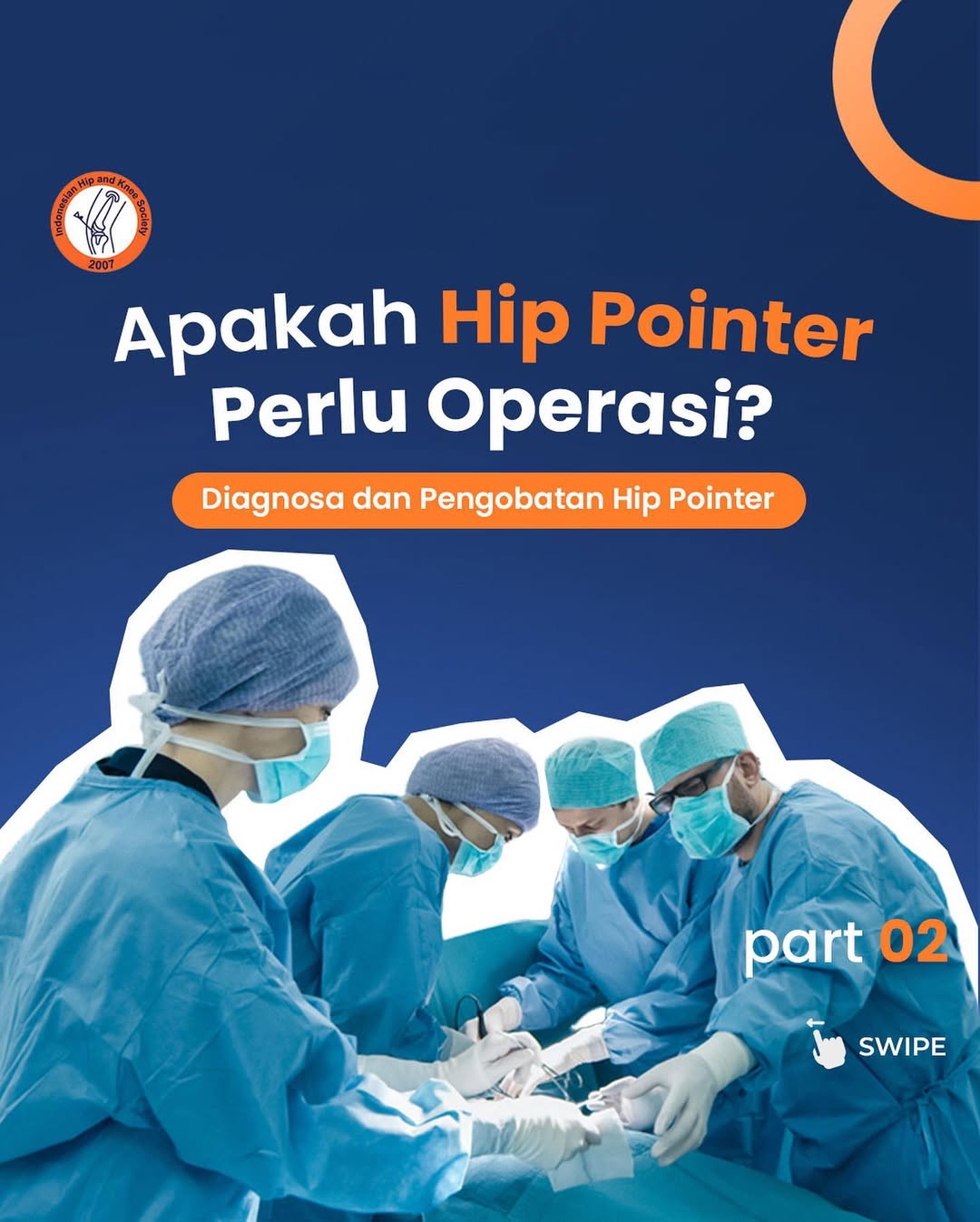 Apakah Hip Pointer Perlu Operasi (Diagnosa dan Pengobatan Hip Pointer)